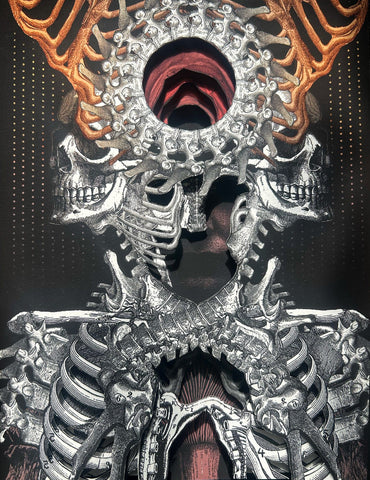 Alex Eckman-Lawn art